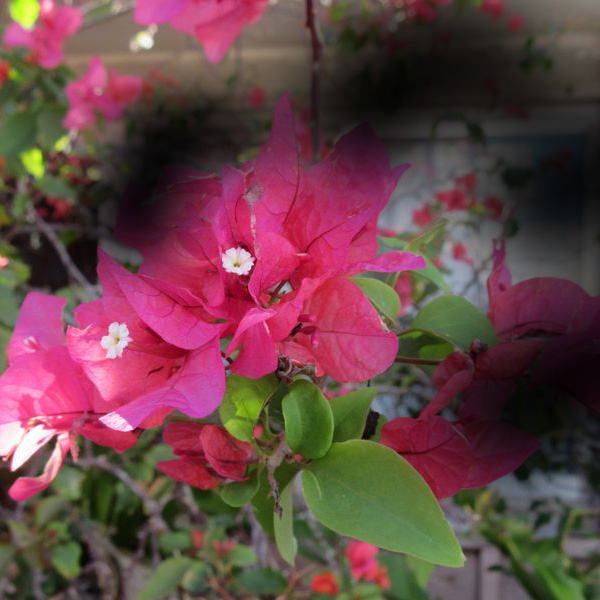 緑内障の進行イメージ：中期