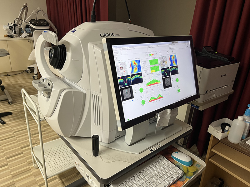 OCT検査:CIRRUS6000(ZEASS)